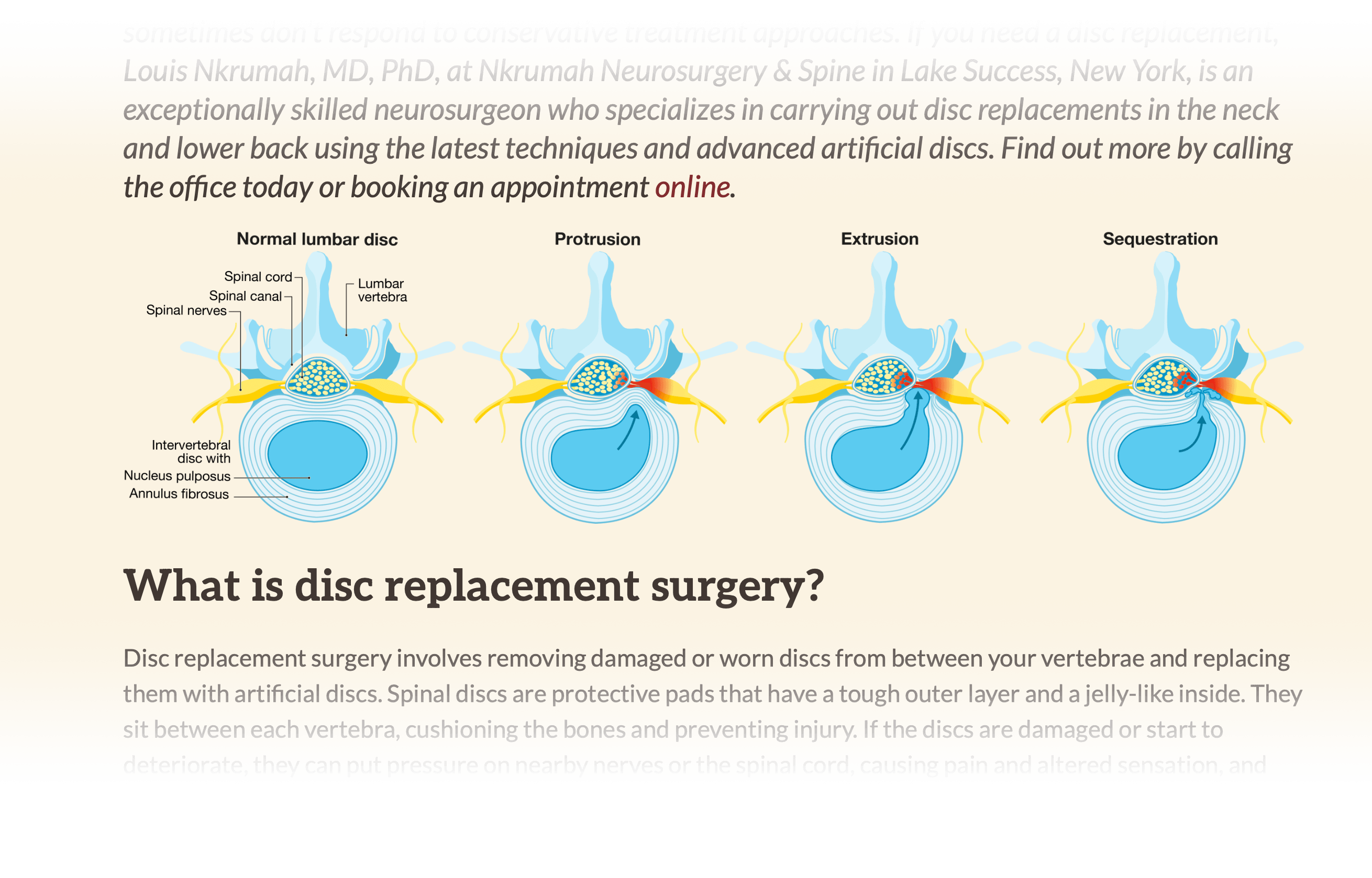 Illustration teaches readers about stages of a medical condition